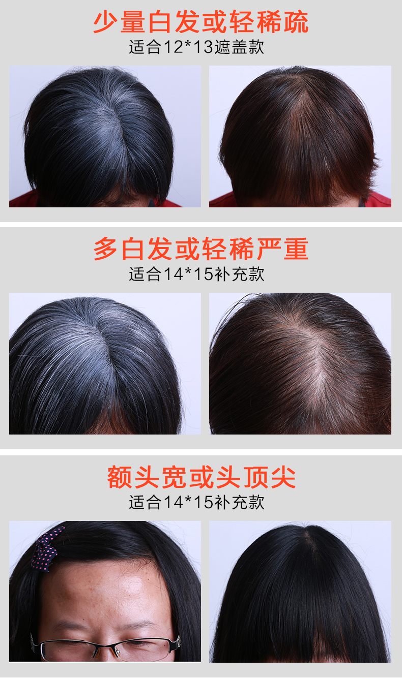 Extension cheveux - Ref 225296 Image 16