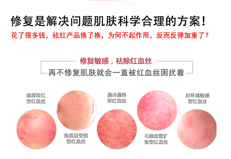 去除红血丝正品特效修复角质层薄增厚抗敏感肌肤玻尿酸原液精华液