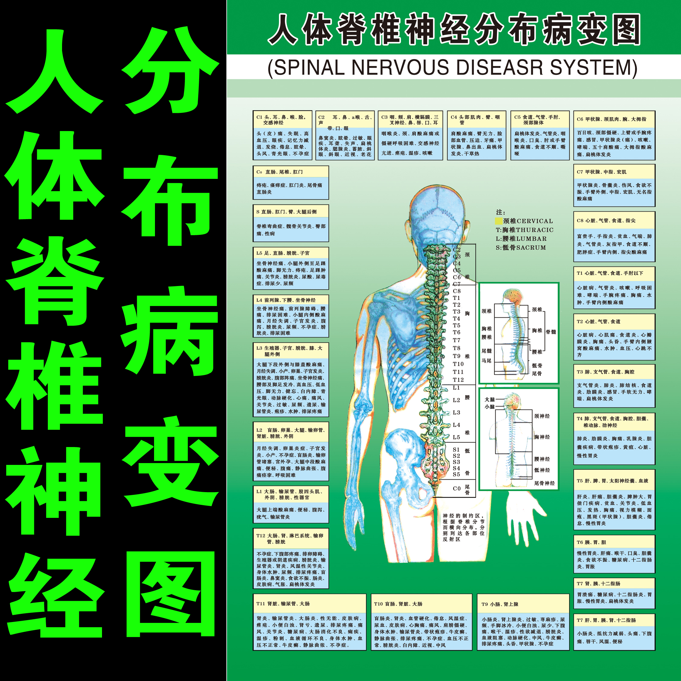 人体脊椎神经分布病变图脊柱医学宣传挂图人体器官解剖图医院海报