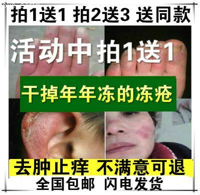 冻疮膏特效正品速效冻必治冻疮膏防冻膏止痒冻伤膏蛇油膏防冻裂膏