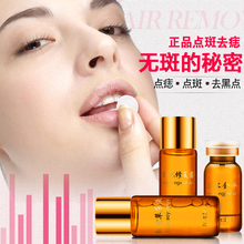 祛痣膏痦子点斑水雀斑脸部取痣黑痣 美容金水去痣点痣药水无痕正品