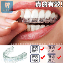 牙医定做牙齿矫正器隐形透明牙套成人龅牙虎牙牙不齐夜间防磨牙套