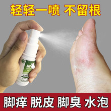 治脚气喷剂脚痒水泡脱皮香港脚糜烂丫脚藓型止痒臭汗杀菌特效去除