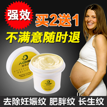 孕妇去妊娠纹祛肥胖纹专用产后前预防消除紧致橄榄油妊辰纹修复霜