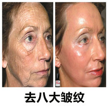 补水精华液正品 去皱纹抗衰老抬头法令纹抗皱提拉紧致面部祛皱保湿
