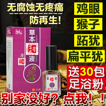 去除瘊子鸡眼膏去疣灵手部跖疣脖子丝状疣甲周疣寻常疣扁平疣特效