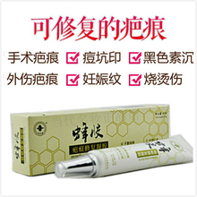 蜂胶去烟疤痕膏灵伤疤手术疤痕剖腹产祛痘印妊娠纹去色素儿童 正品