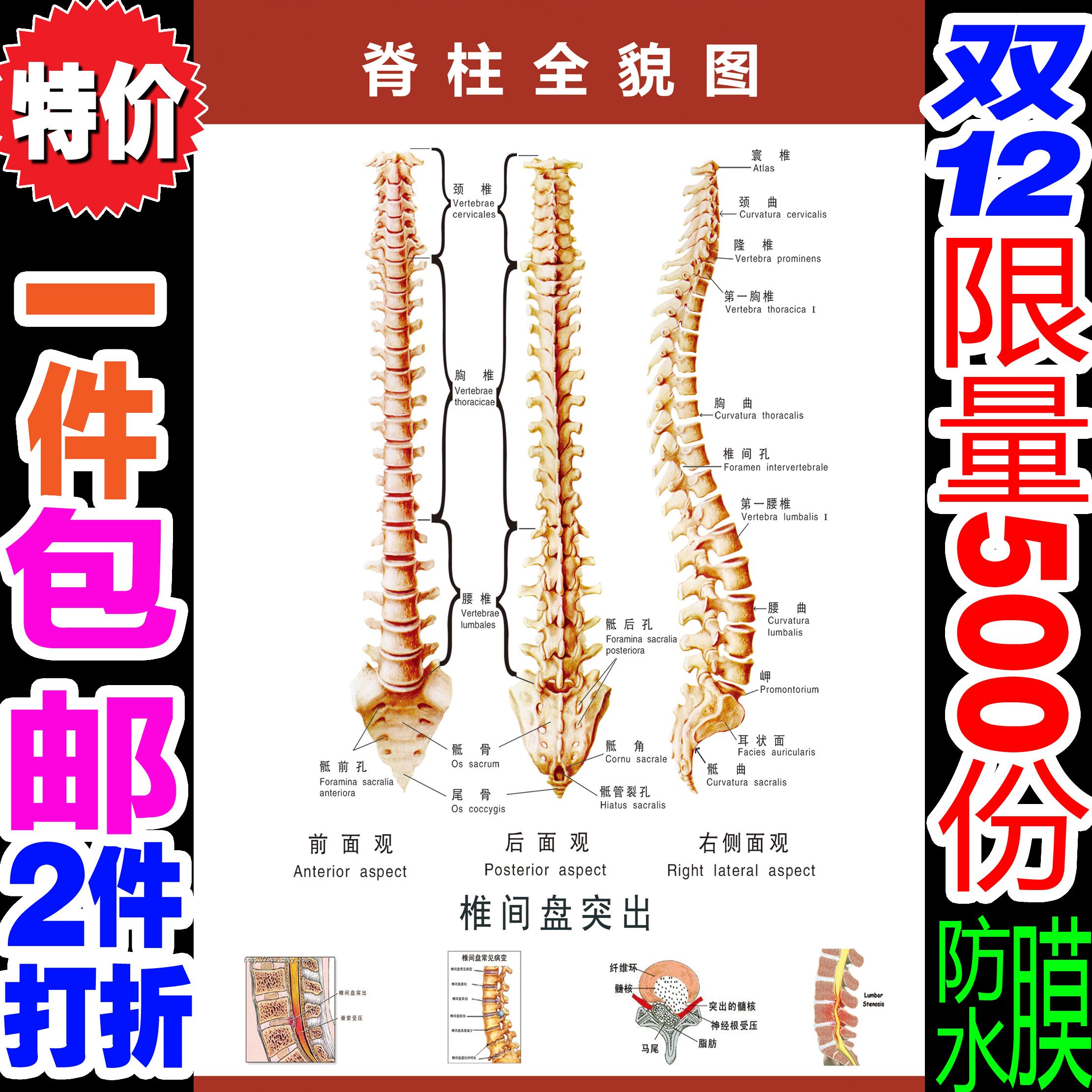 脊椎相关疾病示意图脊柱医学宣传挂图人体器官解剖图医院布置海报