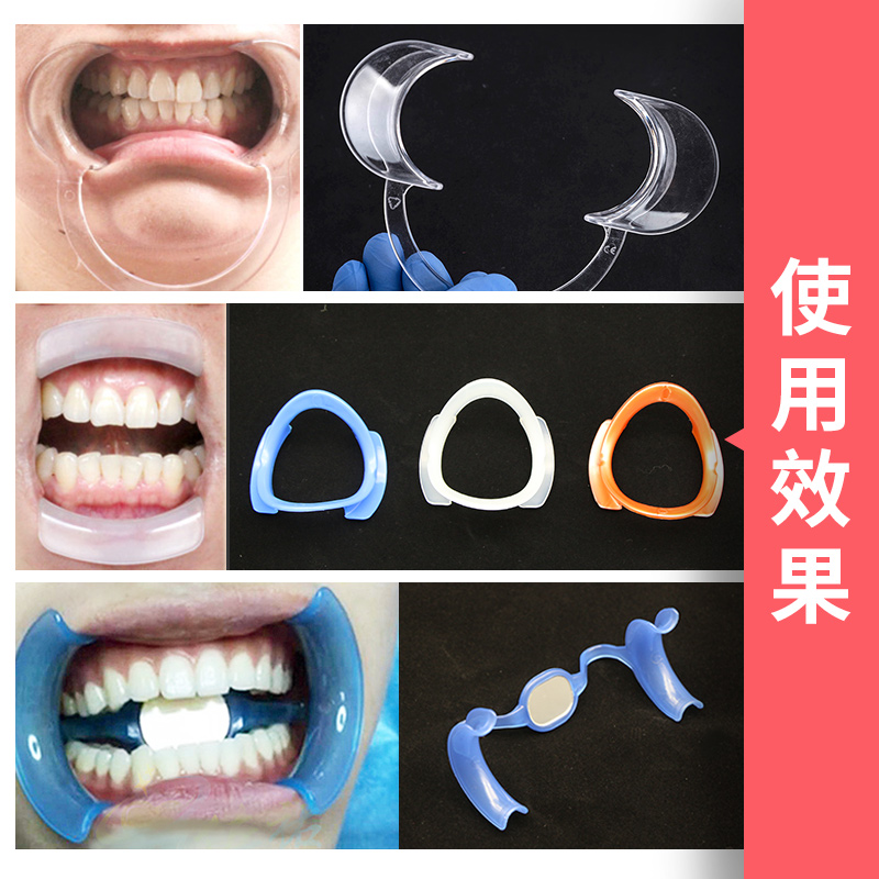 牙科材料 口腔材料 开口器 拉钩 张口器可高温高压消毒满30个包邮
