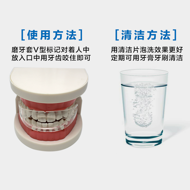 爱牙牙第三代防磨牙牙套成人磨牙套夜间睡觉牙