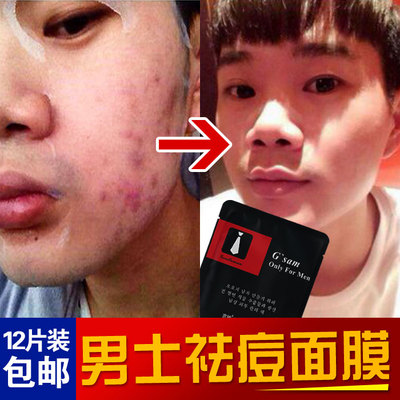 【共14片】锐度男士面膜补水美白 去黑头痘印
