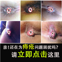 李太医痔疮膏消肉球特效男女性止痒痣疮膏痔痔膏根断膏去草本成人
