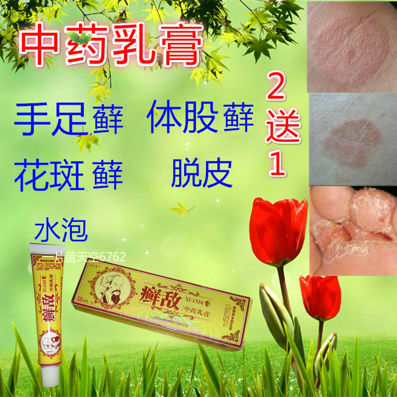男女大腿内侧体股手足皮肤痒藓廯外用软膏肛门阴囊外阴止痒膏成人