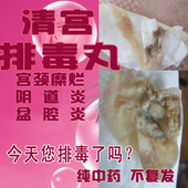 清宫丸子宫頸糜烂重度治疗咨询服务妇科炎症凝胶陰道炎6粒送1洗液