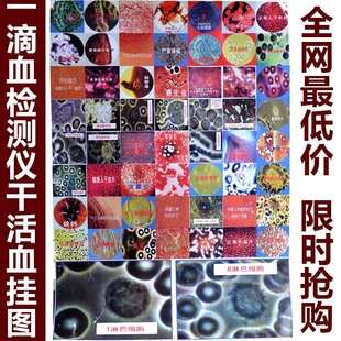天策莱光干活血挂图 血液检测分析对比干血图 活血图 一滴血检仪