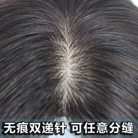 [女士头顶补发]评价 女士头顶脱发怎么样