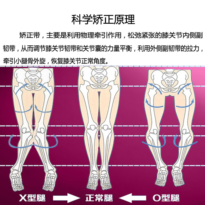 成人x型腿o型腿型矯正帶男女0形糾正美腿部直腿綁腿羅圈腿矯正器