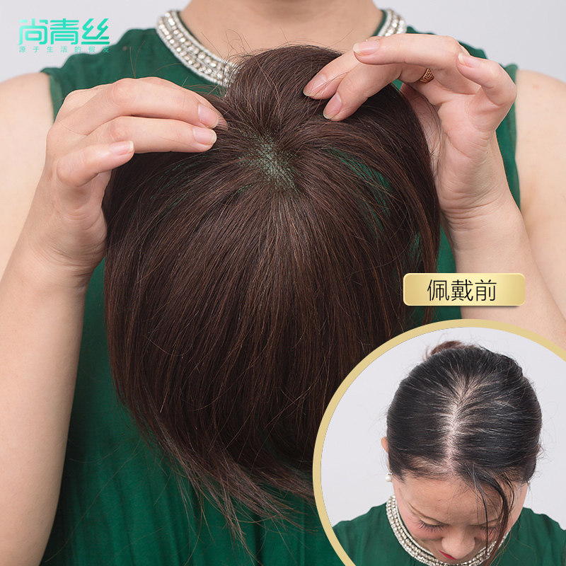 头顶补发