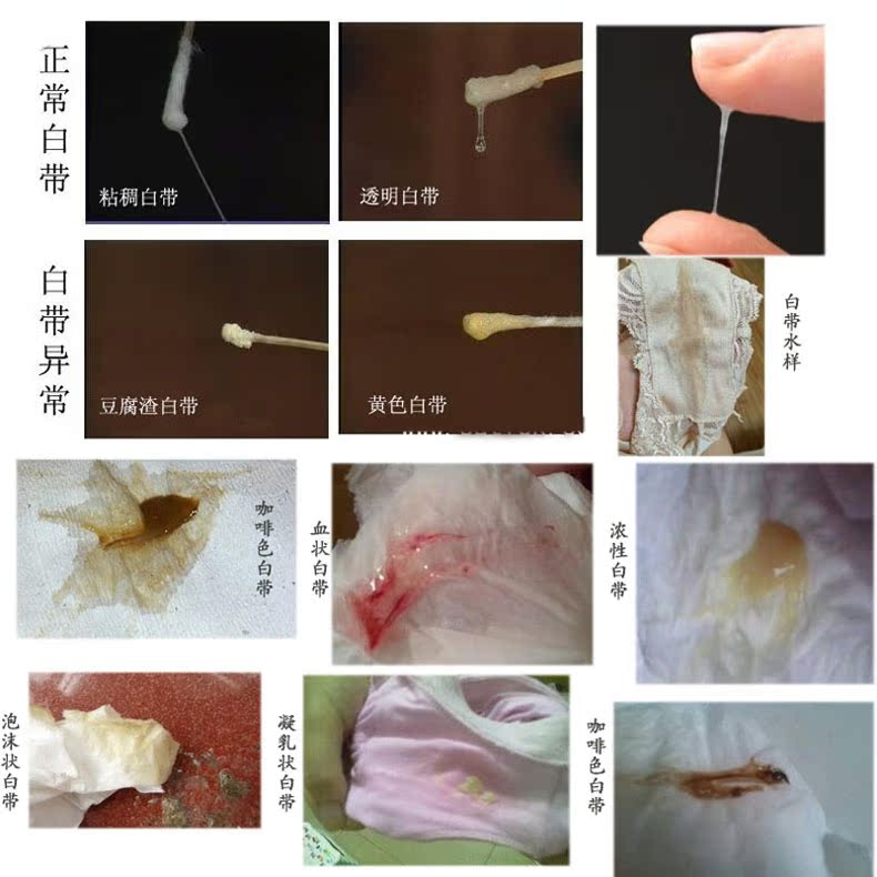 绿友乳酸杆菌洗液水凝胶 妇科霉菌性阴道白带异味私处止痒护理